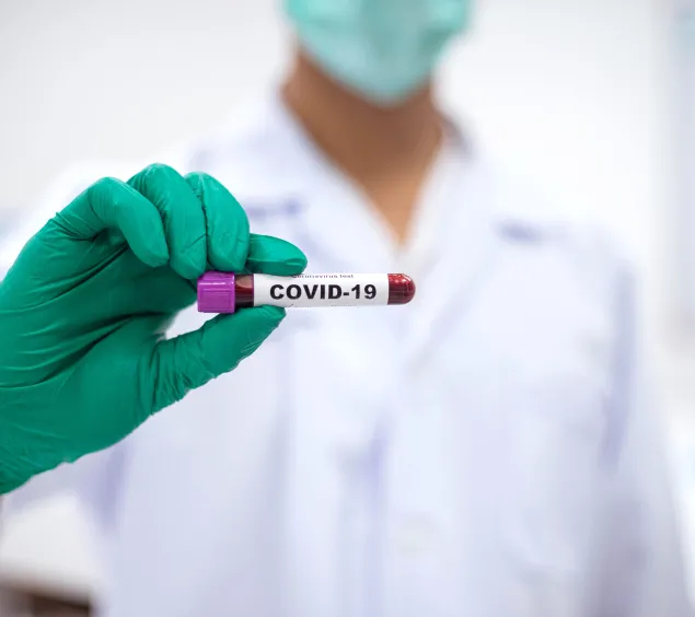 Corona Test