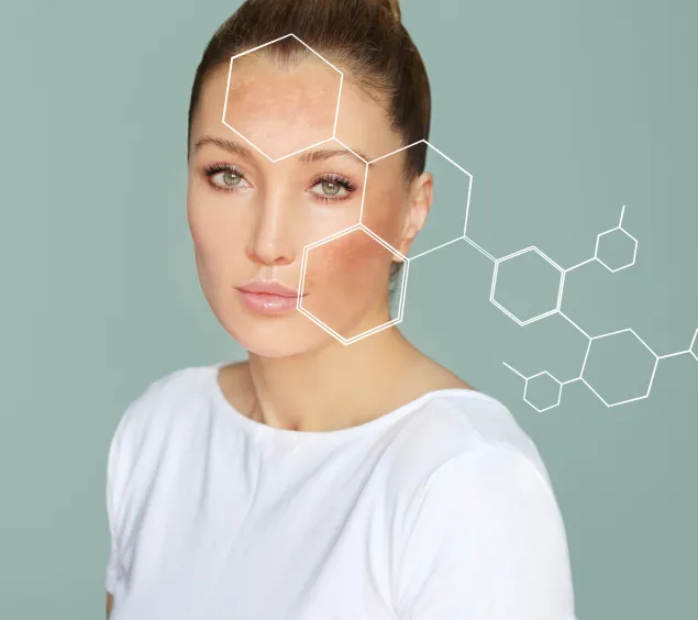 Bild einer Frau, Waben davor/iStock