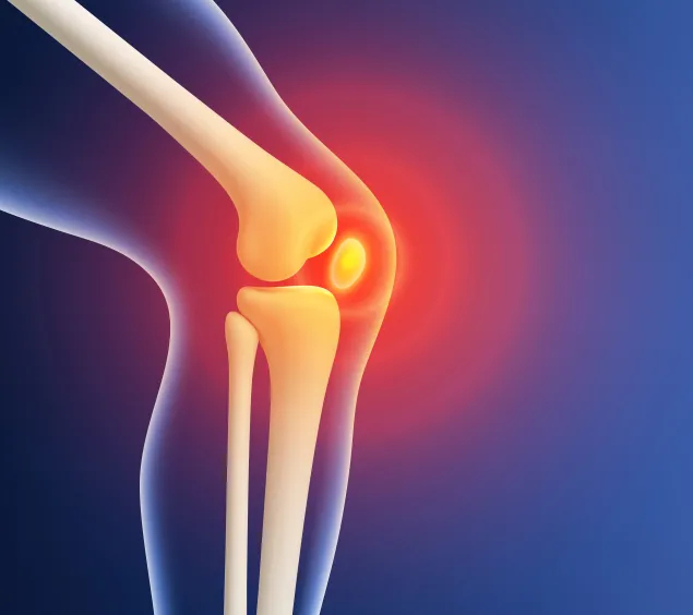 Darstellung eines Kniegelenks