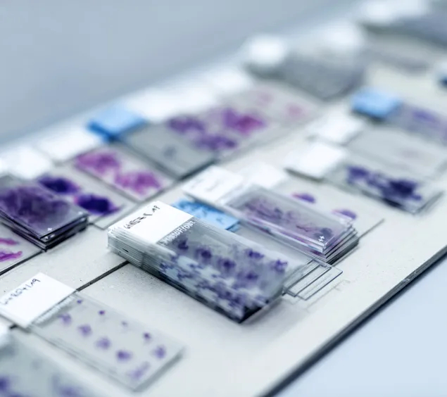 Pathologie Objektträger