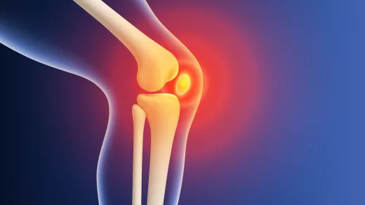 Darstellung eines Kniegelenks