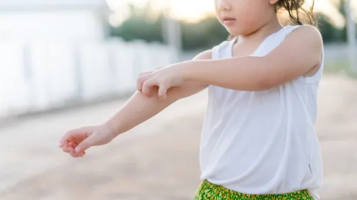 Neurodermitis bei Kindern, Quelle: MIA Studio/Shutterstock.com