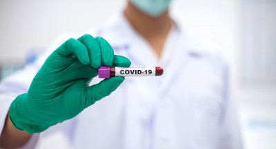 Corona-Virus-Test
